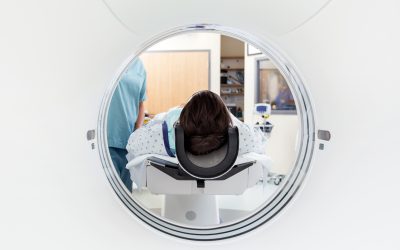 What You Can Expect from CT Scanners in the GE Optima Family