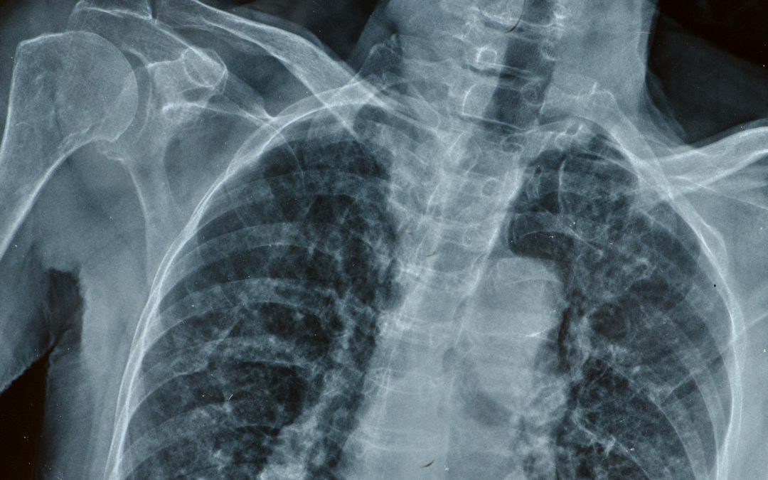 X-Ray Equipment for Your Medical Facility – Which One is Best