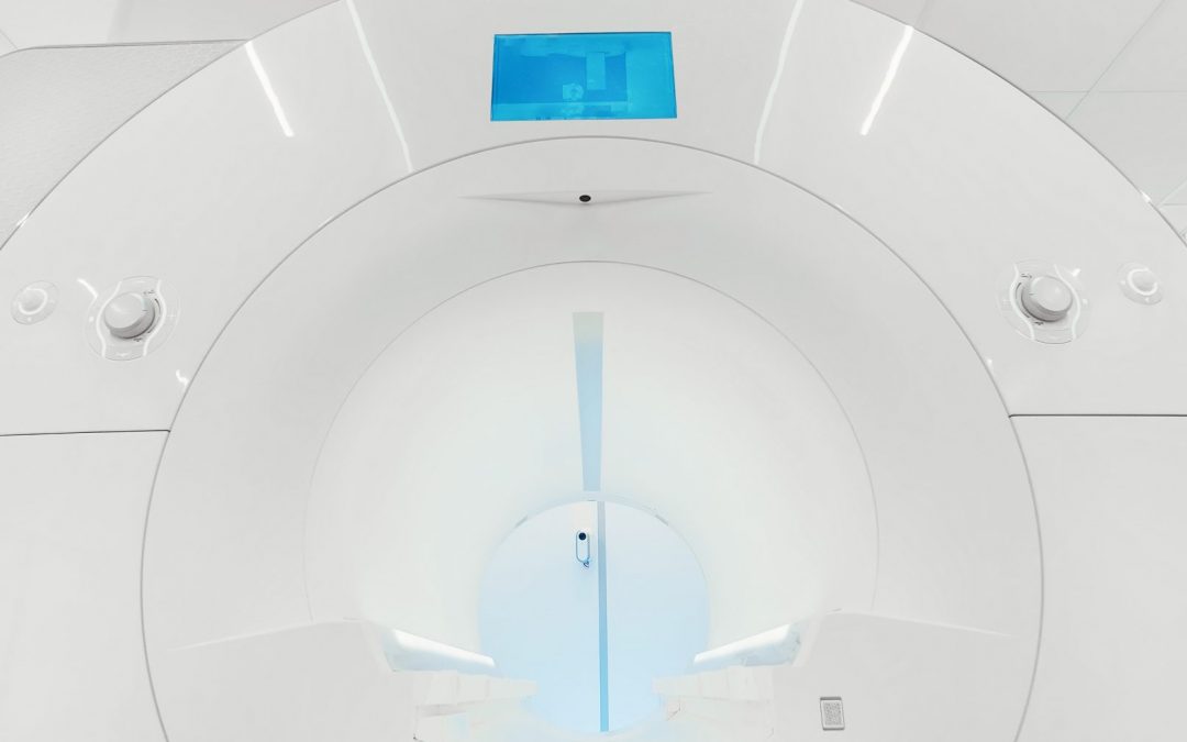 5 Things to Consider in an MRI System for Your Facility